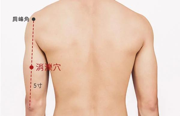 头痛眩晕久咳不愈 艾灸解决10种小毛病