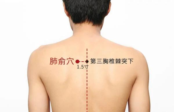 头痛眩晕久咳不愈 艾灸解决10种小毛病