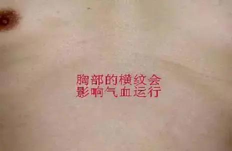 身体上的这些“阻力线” 正在阻碍你气血的运行
