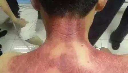 身体上的这些“阻力线” 正在阻碍你气血的运行