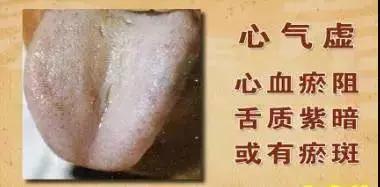 中医补气、养血、养阴、养阳 所有的精华都在这里!