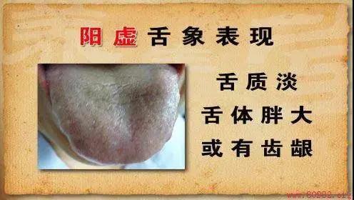 中医补气、养血、养阴、养阳 所有的精华都在这里!