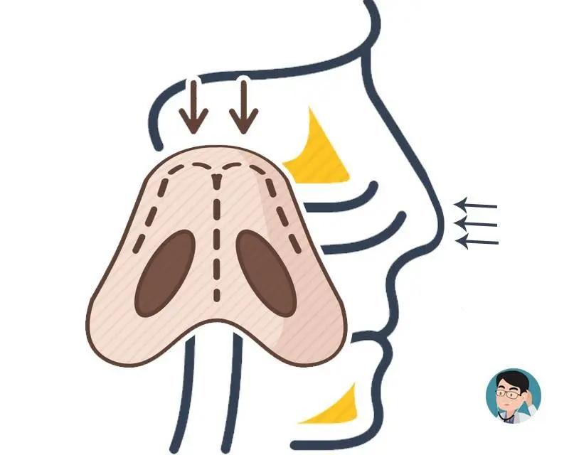 “秋冬吃柚 赛过吃肉” 柚子7大好处 但这3类人再馋也别吃