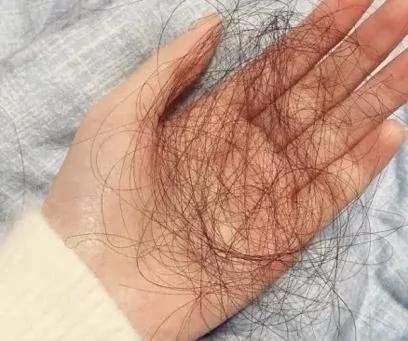 头发一直掉?别害怕 你可能不是真的脱发!避免入坑看这里