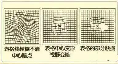 一张图测痴呆、脑梗、视力 50岁后每年都要测!太实用了