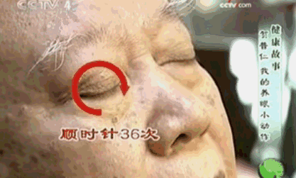一张图测痴呆、脑梗、视力 50岁后每年都要测!太实用了