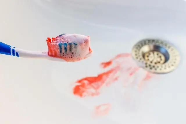 刷牙經常出血的人注意了可能暗示幾種病