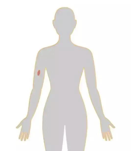 十八张癌症人体地图 揭秘致癌真相