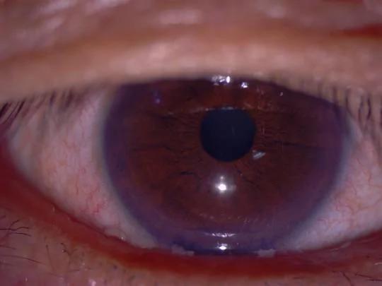 眼睛可能是下一个感染爆发源 眼科医师教日常 双眼防疫 4步骤 阿波罗新闻网