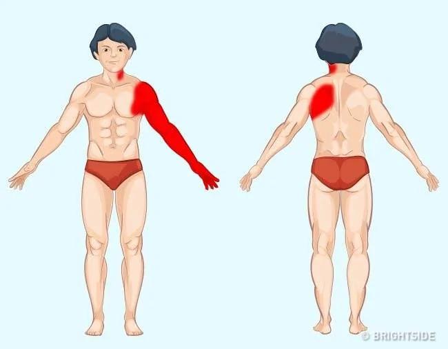 9張圖解讓你秒懂身體部位會疼痛的原因