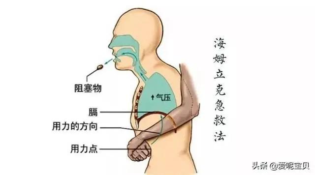 每年近3000名寶寶因噎住窒息死亡!是什麼讓食物變成「毒藥」 6 20200626094240190
