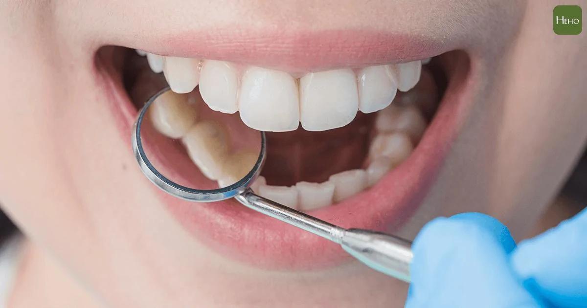 好好刷牙吧！權威期刊：牙周病讓胃癌、食道癌風險飆升50%