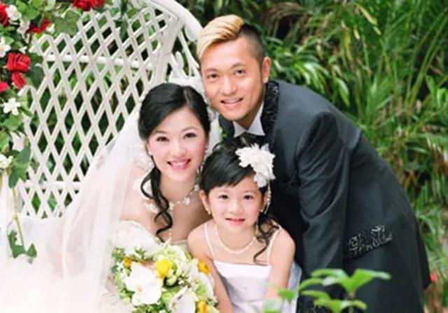 知名歌手被灯光灼伤 眼角膜变绿色短暂失明 事隔多年仍心有余悸