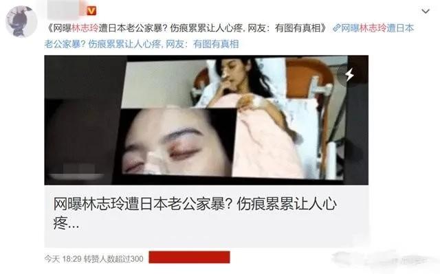 林志玲老公黑泽良平谈生育观:绝不会给爱妻压力