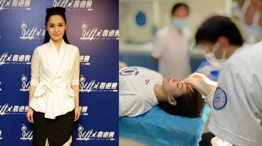 阿娇半夜晕眩自摔“头缝数十针”恐破相
