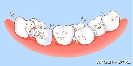 你以為堅持勤刷牙、不吃糖 就不會蛀牙了嗎?太天真了 4 你以為堅持勤刷牙、不吃糖 就不會蛀牙了嗎?太天真了