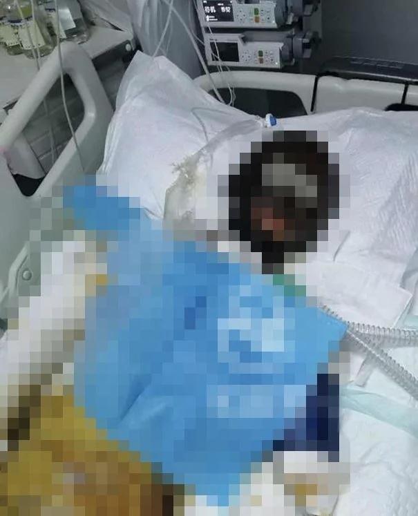 网红遭「泼汽油烧死」!渣前夫长年家暴 连姊也被打到送医
