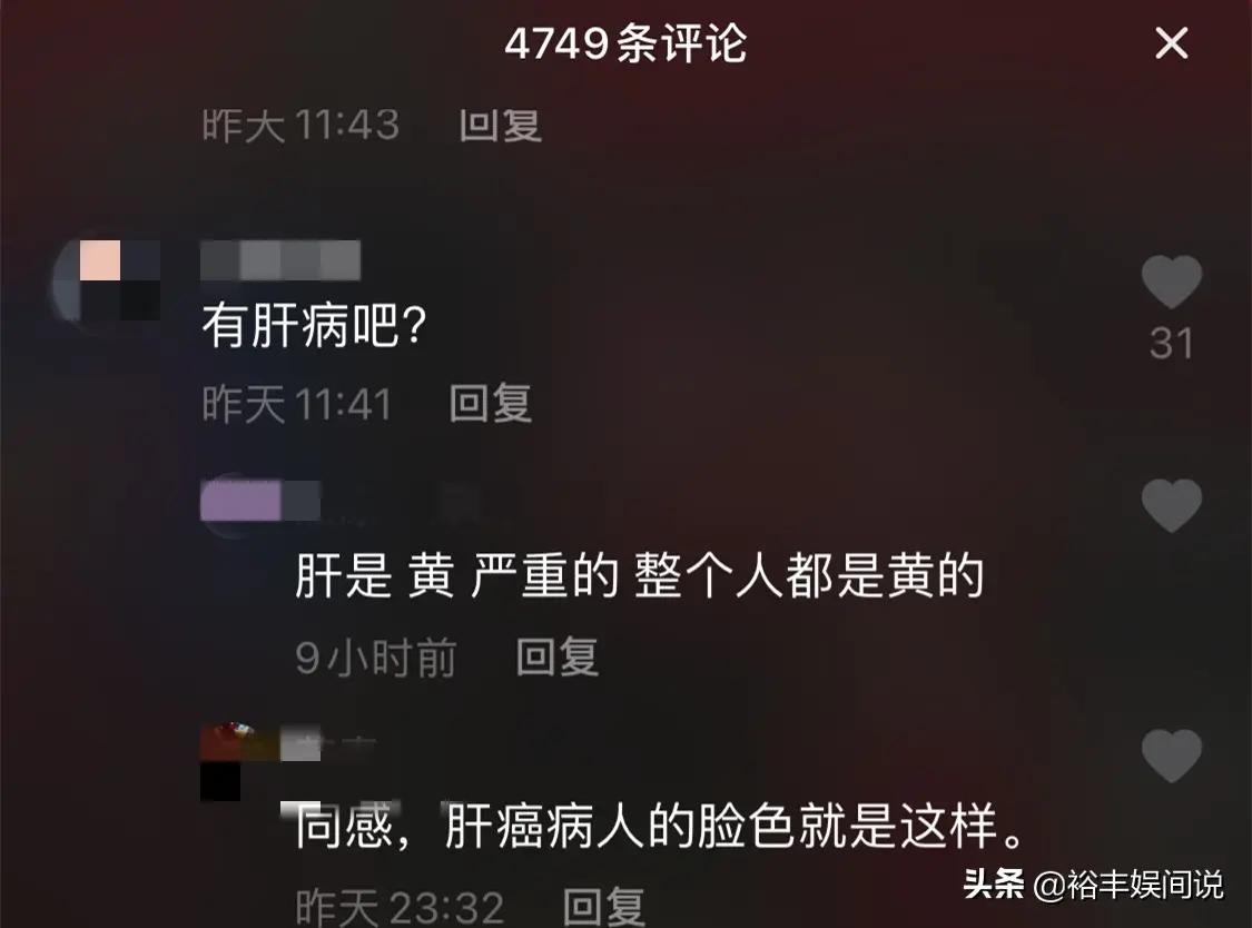 阿宝罕有现身活动现场 胡子扎小辫十分抢眼 脸色发黑病态十足