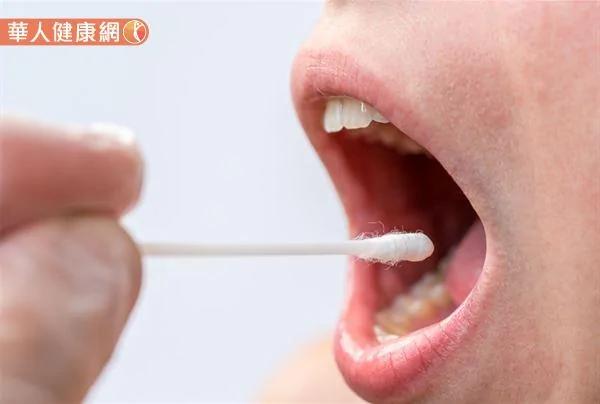 「口腔癌」在男性癌症發生率、死亡率排名第四！3步驟遠離口腔癌噩夢