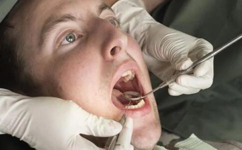 口腔潰瘍復發性強 醫生告訴你如何有效預防