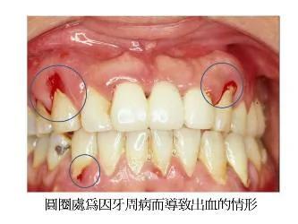 怀一个孩子就坏一颗牙?!