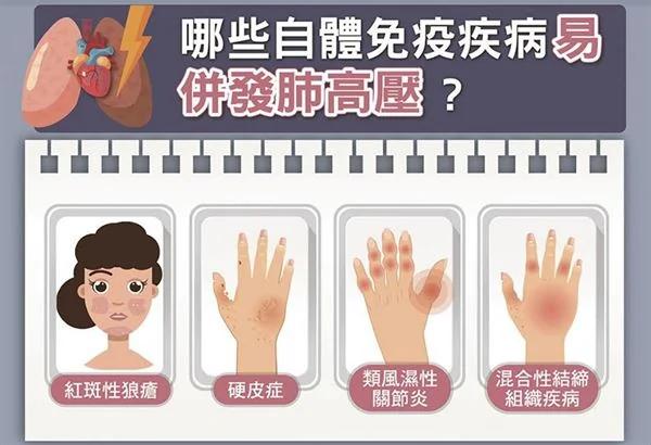 肺动脉高压非高血压 是心脏的癌症!PK小绿人步行测试 帮助发觉疾病警讯!
