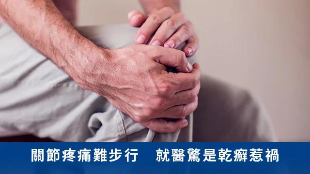 關節疼痛難步行就醫驚是乾癬惹禍！醫師：日常多留意 避免延誤治療時機