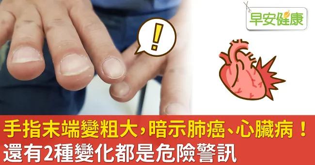 手指末端变粗大 暗示肺癌、心脏病!还有2种变化都是危险警讯