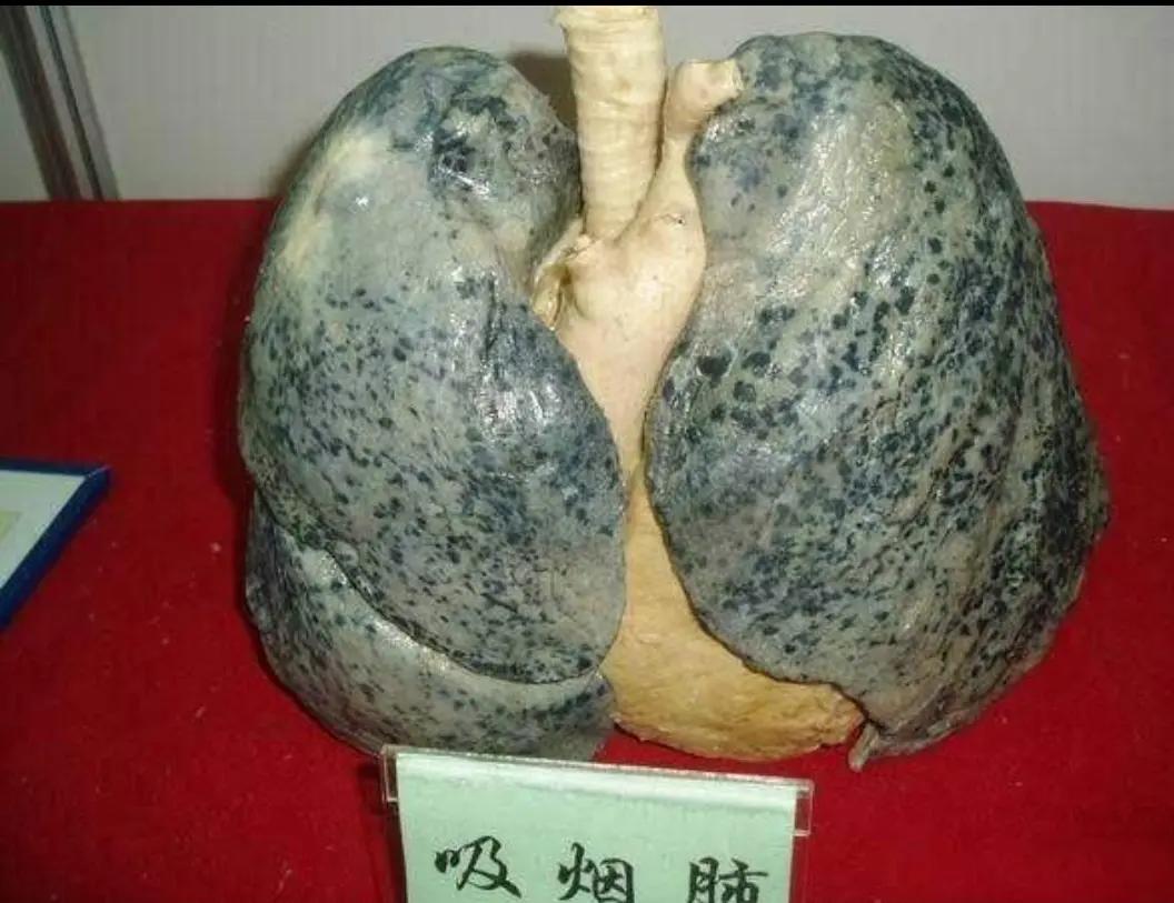 吸烟者 你的身体正在进行着这些变化