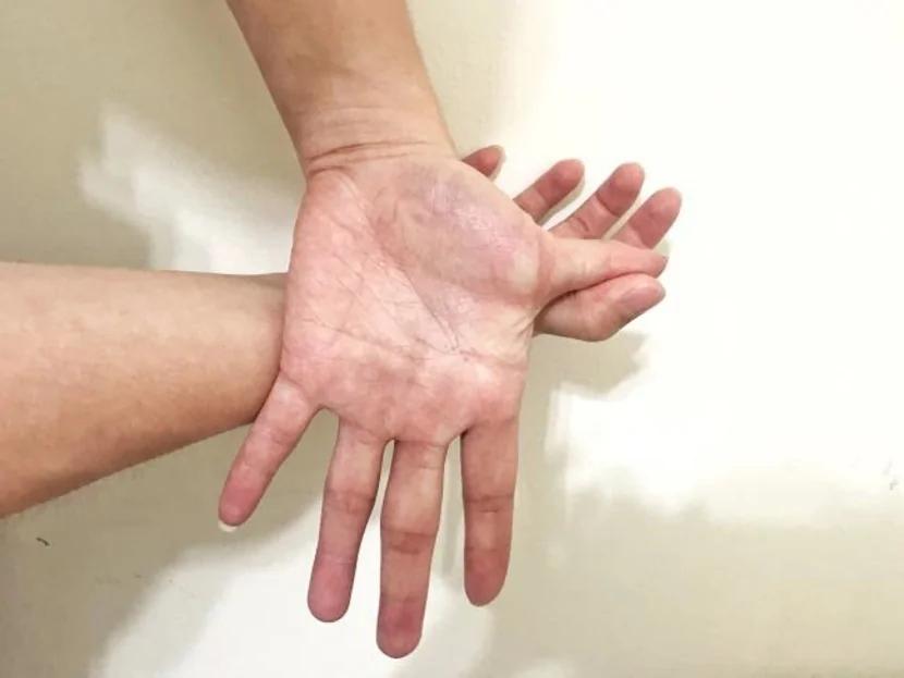每分鐘狂點滑鼠400下打電動如何手不痛 醫師教你3招