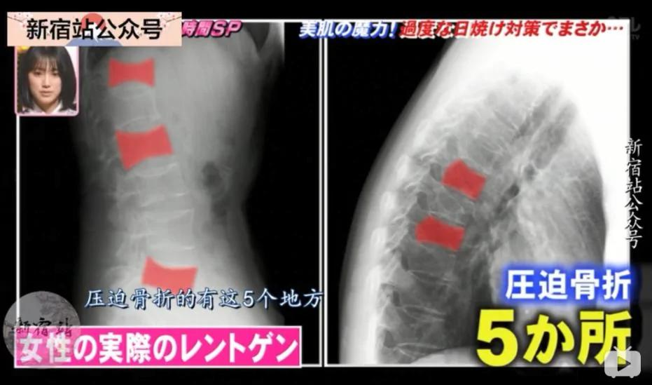 防晒的结果是「变矮」?这个错误你也可能在犯!