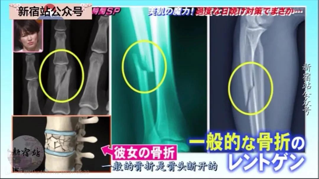 防晒的结果是「变矮」?这个错误你也可能在犯!