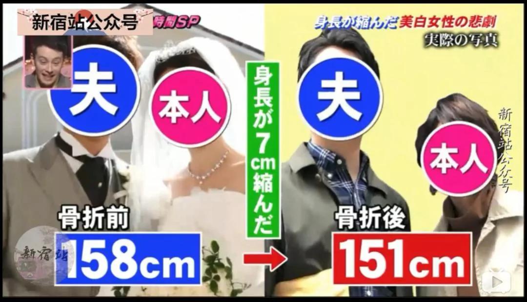 防晒的结果是「变矮」?这个错误你也可能在犯!
