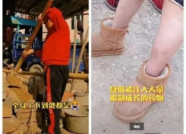 「小馬雲」慘狀曝光：智力下降、腿上全是針眼
