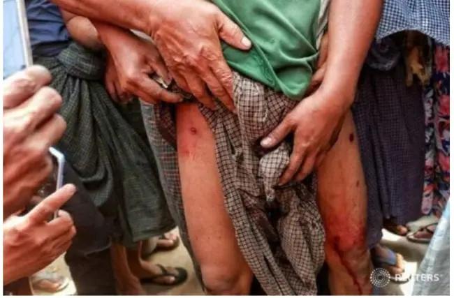 緬甸死傷遍地宛如六四 疑似「炸子」再現