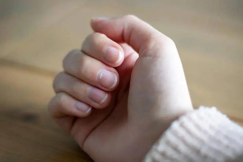 指甲上的豎紋，是疾病的徵兆嗎？關於指甲的 8 個秘密