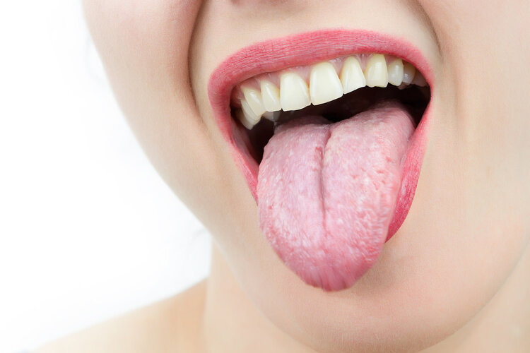 舌頭吐露的身體秘密：出現這6種變化，暗示你生大病了！趕緊治療