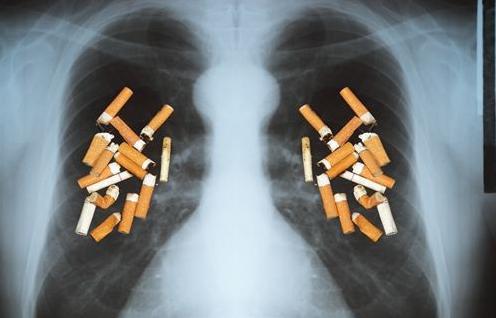 多數「肺癌」發現就是晚期？若這3處疼痛，可能是肺在「求救」！