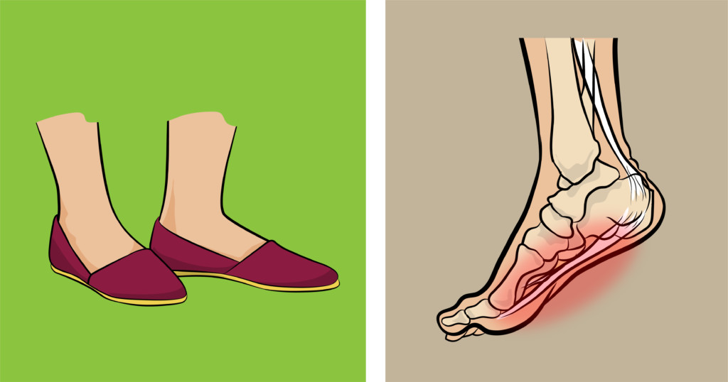 腳痛卻不知原因？6種「最會傷腳的鞋子」跑步鞋其實也不安全