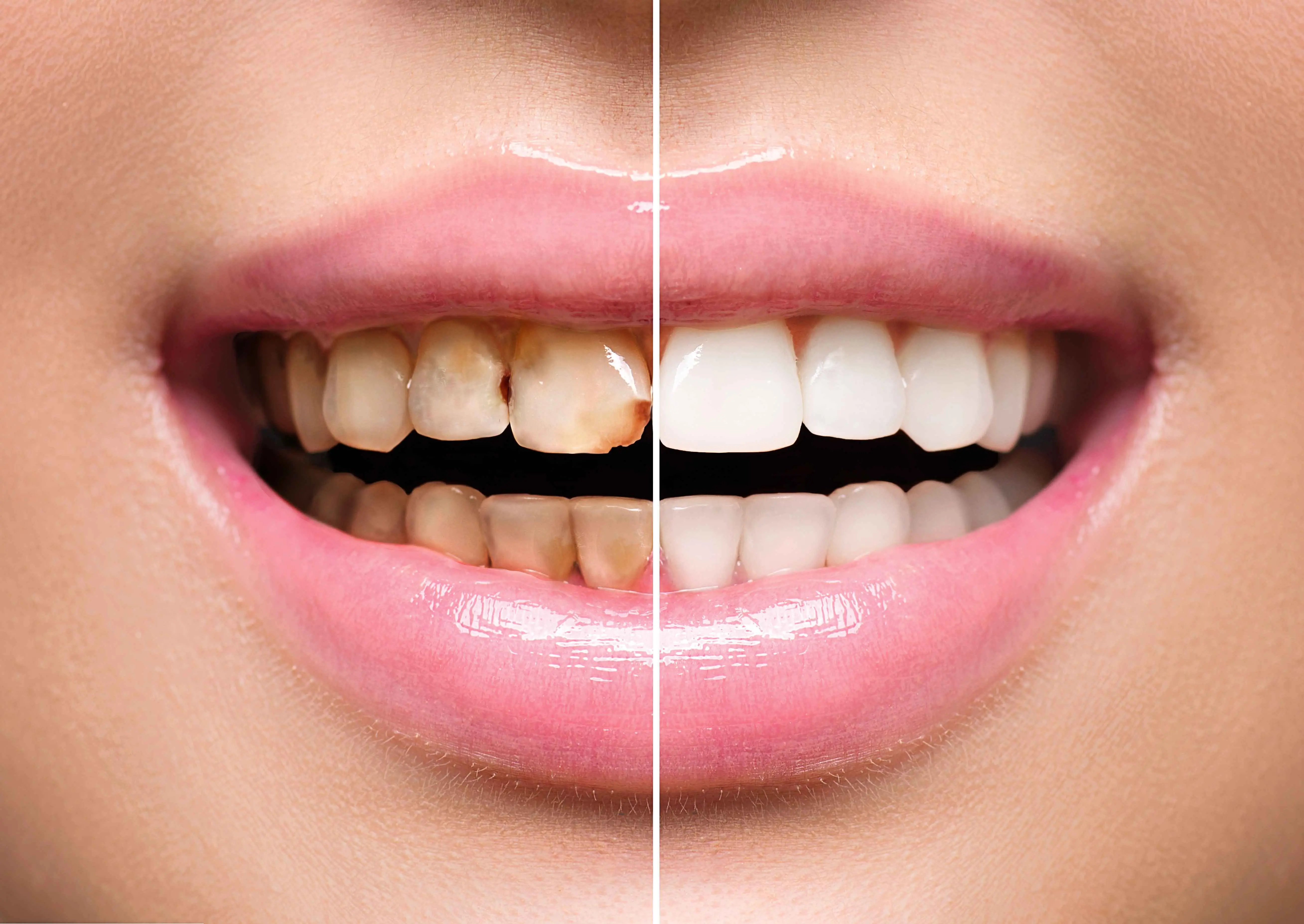 不想牙齿早早脱落？提醒：日常做好这5点，有助于保护牙齿健康