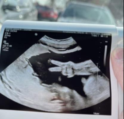 寶媽產檢驚見腹中胎兒這動作，醫驚：第一次見到