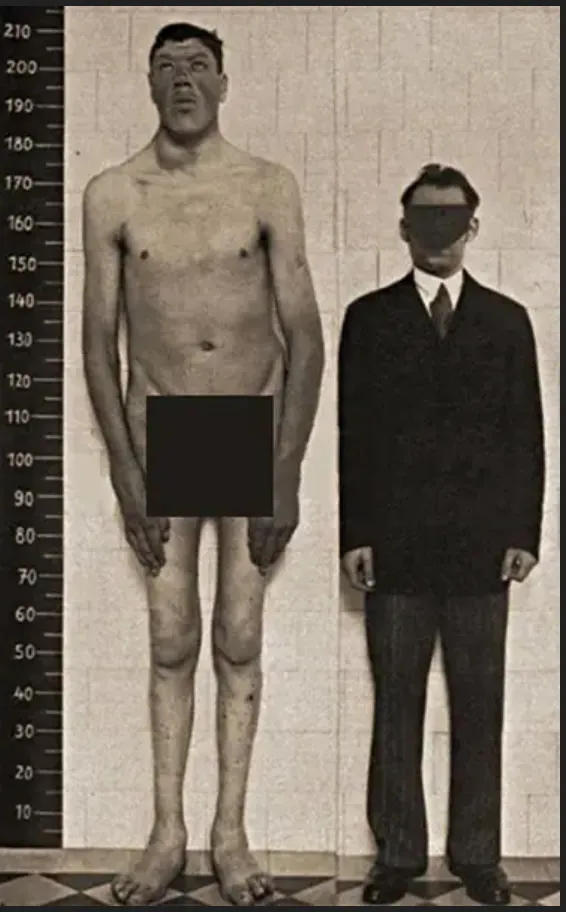 亞當在10年間從120幾公分長到216公分，引起相關領域的醫生們注意。金氏世界紀錄網站