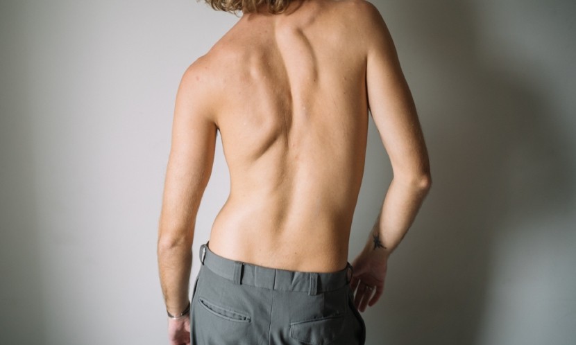 脊椎侧弯孩子需要穿背架的4个时机