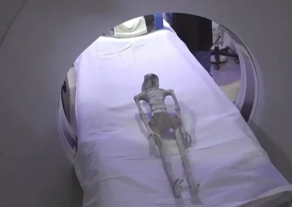 墨西哥外星人屍體做斷層掃描，再有驚人發現「非人造、非拼裝」。（翻自《太陽報》）