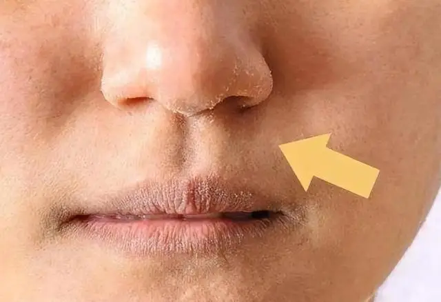 “鼻毛变白”是衰老前兆？或与这4个原因有关，男性最好重视起来