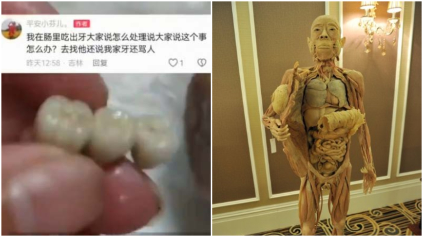 香肠吃出牙齿背后：大连人体标本公司还销售食品