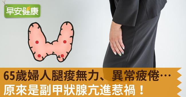 63岁妇人腿酸无力、异常疲倦…原来是副甲状腺亢进惹祸