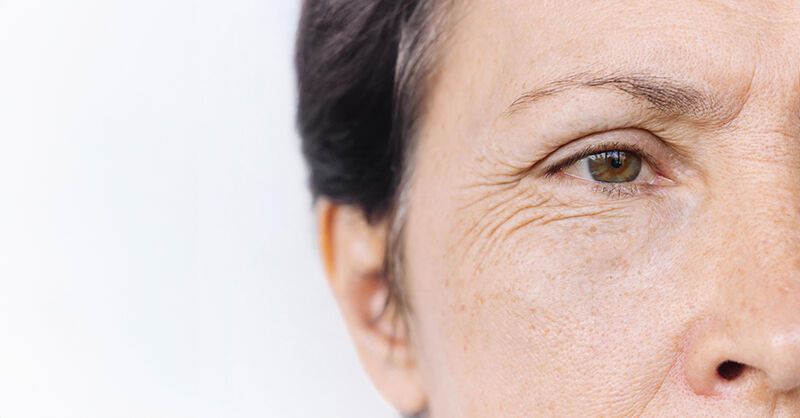 照镜子看眼角！研究：长得越“糙老”失智风险可能高6成