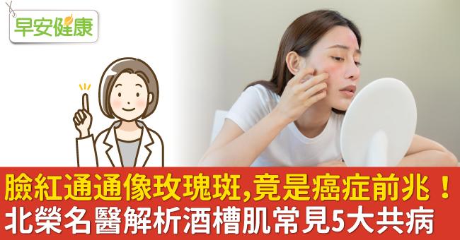 脸红通通像玫瑰斑，竟是癌症前兆！北荣名医解析酒槽肌常见5大共病