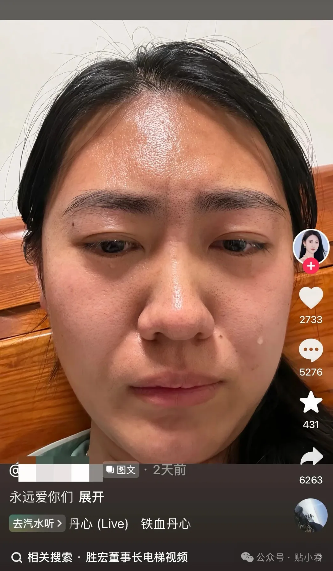 史上最貴的吻,540億沒了